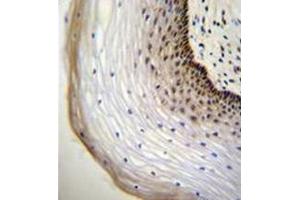 Immunohistochemistry analysis in formalin fixed and paraffin embedded human cervical tissue reacted with NUP107 Antibody (Center) followed by peroxidase conjugation of the secondary antibody and DAB staining.