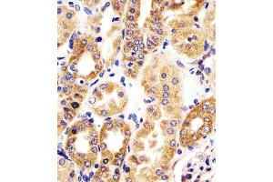 (ABIN6242146 and ABIN6578339) staining HTR1E in human kidney tissue sections by Immunohistochemistry (IHC-P - paraformaldehyde-fixed, paraffin-embedded sections).