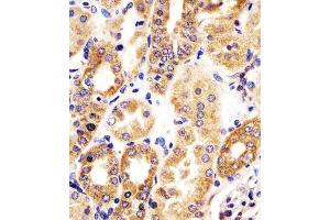 (ABIN6242146 and ABIN6578339) staining HTR1E in human kidney tissue sections by Immunohistochemistry (IHC-P - paraformaldehyde-fixed, paraffin-embedded sections). (Serotonin Receptor 1E anticorps  (AA 223-258))