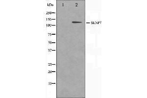 Western blot analysis on HuvEc cell lysate using SENP7 Antibody,The lane on the left is treated with the antigen-specific peptide. (SENP7 anticorps  (C-Term))
