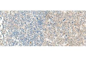Immunohistochemistry of paraffin-embedded Human tonsil tissue using NPBWR1 Polyclonal Antibody at dilution of 1:50(x200) (NPBWR1 anticorps)