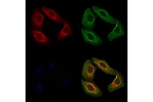ABIN7093916 and ABIN7097960 staining Hela cells by IF/ICC. (MGAT1 anticorps  (C-Term))