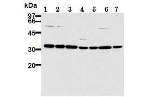 Western Blotting (WB) image for anti-Cyclin-Dependent Kinase 2 (CDK2) antibody (ABIN1106646) (CDK2 anticorps)