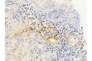 ABIN6260256 and ABIN6278211 at 1/100 staining human normal gastric tissue by IHC-P.