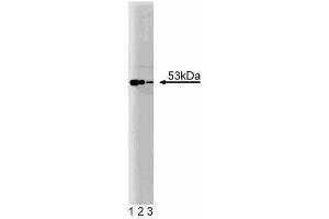 Western blot analysis of TRAF4 on Jurkat lysate. (TRAF4 anticorps  (AA 2-160))