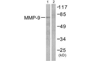 Western Blotting (WB) image for anti-Matrix Metallopeptidase 9 (Gelatinase B, 92kDa Gelatinase, 92kDa Type IV Collagenase) (MMP9) (C-Term) antibody (ABIN1848693) (MMP 9 anticorps  (C-Term))
