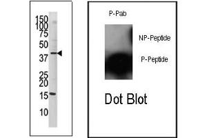 Image no. 2 for anti-Jun Proto-Oncogene (JUN) (pSer63) antibody (ABIN358110) (C-JUN anticorps  (pSer63))
