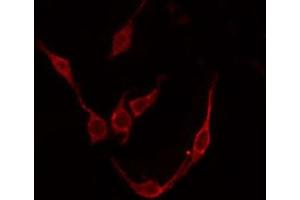 ABIN6276059 staining COLO205 by IF/ICC. (TACR3 anticorps  (C-Term))
