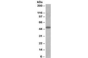Western blot testing of human muscle lysate with OSBPL1A antibody at 0. (OSBPL1A anticorps)