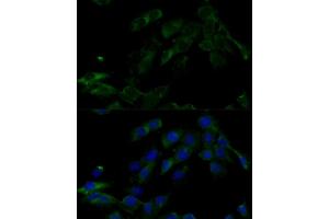 Immunofluorescence analysis of C6 cells using V0C Polyclonal Antibody  at dilution of 1:100 (40x lens).