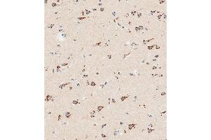 Immunohistochemical analysis of paraffin-embedded human brain tissue using (ABIN387940 and ABIN2844497) performed on the Leica® BOND RXm.