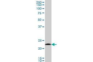 PSMB6 monoclonal antibody (M02), clone S51 Western Blot analysis of PSMB6 expression in A-431 .