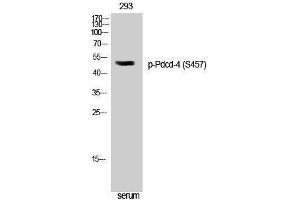 Western Blotting (WB) image for anti-Programmed Cell Death 4 (PDCD4) (pSer457) antibody (ABIN3182643) (PDCD4 anticorps  (pSer457))