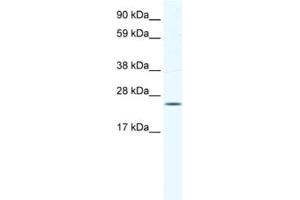 Western Blotting (WB) image for anti-Potassium Channel Tetramerisation Domain Containing 6 (KCTD6) antibody (ABIN2461578) (KCTD6 anticorps)