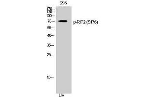Western Blotting (WB) image for anti-ROP Interactive Partner 2 (RIP2) (pSer176) antibody (ABIN3182676) (RIP2 anticorps  (pSer176))