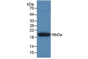 Detection of Recombinant TNC, Human using Polyclonal Antibody to Tenascin C (TNC) (TNC anticorps  (AA 49-181))