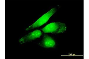Immunofluorescence of monoclonal antibody to NFE2L2 on HeLa cell.