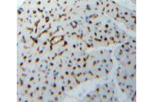 Used in DAB staining on fromalin fixed paraffin-embedded heart tissue (TNNI2 anticorps  (AA 1-182))