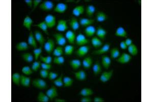 Immunofluorescence staining of Hela cells with ABIN7173520 at 1:166, counter-stained with DAPI. (C2orf60 anticorps  (AA 1-152))