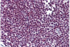 Human Spleen: Formalin-Fixed, Paraffin-Embedded (FFPE) (FOXO3 anticorps  (AA 361-460))