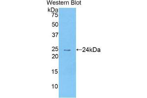 Western Blotting (WB) image for anti-Chemokine (C-C Motif) Ligand 25 (CCL25) (AA 24-150) antibody (ABIN1174416) (CCL25 anticorps  (AA 24-150))