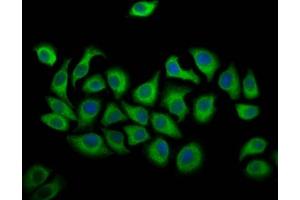 Immunofluorescence staining of A549 cells with ABIN7144528 at 1:166, counter-stained with DAPI. (ALOX12 anticorps  (AA 508-658))