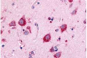 Anti-NEK7 antibody  ABIN1049091 IHC staining of human brain, neurons and glia. (NEK7 anticorps  (Kinase Domain))
