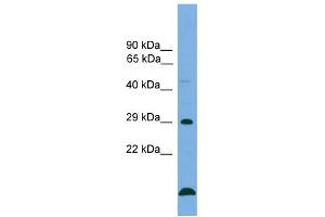 WB Suggested Anti-BCL2 Antibody Titration: 0. (Bcl-2 anticorps  (Middle Region))