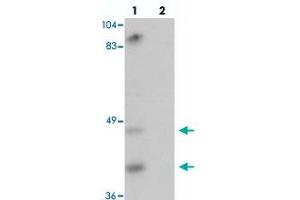 Western blot analysis of TMPRSS11A in mouse liver tissue with TMPRSS11A polyclonal antibody  at 1 ug/mL in (lane 1) the absence and (lane 2) the presence of blocking peptide.