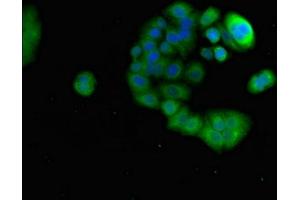 Immunofluorescent analysis of PC-3 cells using ABIN7164763 at dilution of 1:100 and Alexa Fluor 488-congugated AffiniPure Goat Anti-Rabbit IgG(H+L) (PRR11 anticorps  (AA 1-360))