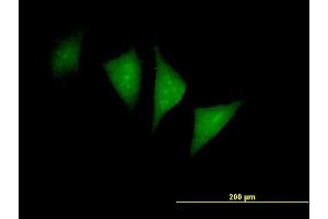 Immunofluorescence of purified MaxPab antibody to PFTK1 on HeLa cell.