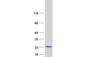 Validation with Western Blot