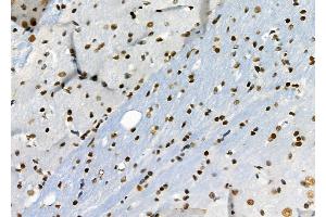 ABIN6264661 and ABIN6276692 at 1/100 staining Rat brain tissue by IHC-P. (Retinoblastoma Binding Protein 4 anticorps  (C-Term))