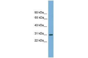 WB Suggested Anti-HLA-DQA2 Antibody Titration:  0. (HLA-DQA2 anticorps  (Middle Region))