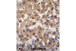 PRAMEF6 Antibody (C-term) immunohistochemistry analysis in formalin fixed and paraffin embedded human liver tissue followed by peroxidase conjugation of the secondary antibody and DAB staining. (PRAMEF6 anticorps  (C-Term))