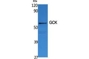 Western Blot (WB) analysis of specific cells using GCK Polyclonal Antibody. (GCK anticorps  (N-Term))