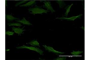 Immunofluorescence of monoclonal antibody to CYP1A2 on HeLa cell.