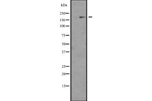 Western blot analysis of NCOA1 expression in KAT13A / SRC1 transfected 293 cell line lysate;,The lane on the left is treated with the antigen-specific peptide. (NCOA1 anticorps)