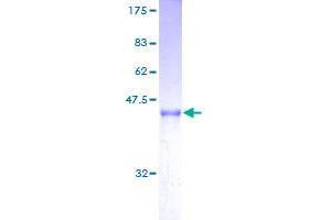 SDS-PAGE (SDS) image for ADP-Ribosylation Factor-Like 2 Binding Protein (ARL2BP) (AA 1-163) protein (GST tag) (ABIN1345605)