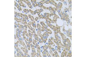 Immunohistochemistry of paraffin-embedded human liver damage using NTF4 antibody (ABIN3021387, ABIN3021388, ABIN3021389 and ABIN6214994) at dilution of 1:100 (40x lens).