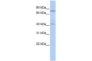 WB Suggested Anti-KLHL3 Antibody Titration:  0. (KLHL3 anticorps  (Middle Region))