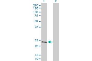 Western Blot analysis of TIMP2 expression in transfected 293T cell line by TIMP2 MaxPab polyclonal antibody.