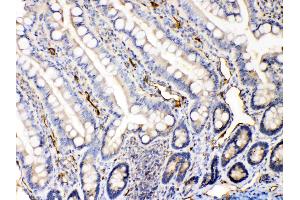 IHC analysis of Bax using anti-Bax antibody . (BAX anticorps  (N-Term))