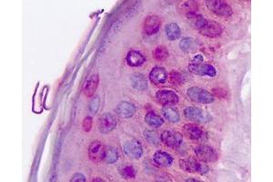 Anti-ROR Alpha / RORA antibody IHC staining of human skin.