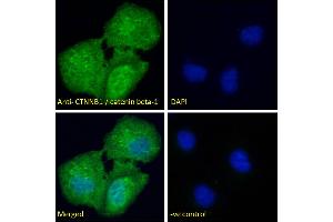 ABIN2630016 Immunofluorescence analysis of paraformaldehyde fixed U2OS cells, permeabilized with 0. (CTNNB1 anticorps  (AA 108-121))