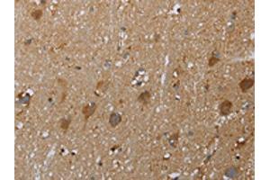 The image on the left is immunohistochemistry of paraffin-embedded Human brain tissue using ABIN7129016(COX6B2 Antibody) at dilution 1/50, on the right is treated with fusion protein. (COX6B2 anticorps)