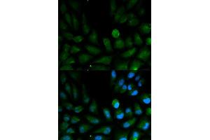 Immunofluorescence analysis of HepG2 cell using CAPZA2 antibody. (CAPZA2 anticorps  (AA 1-286))