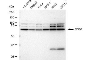 Western blotting analysis using CD86 antibody (ABIN7797984).