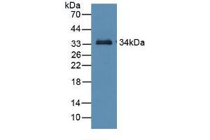 Western blot analysis of recombinant Mouse RBP3. (RBP3 anticorps  (AA 18-320))