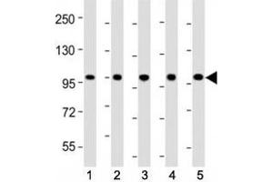 Western blot testing of LGR-5 antibody at 1:2000 dilution. (LGR5 anticorps  (AA 689-719))